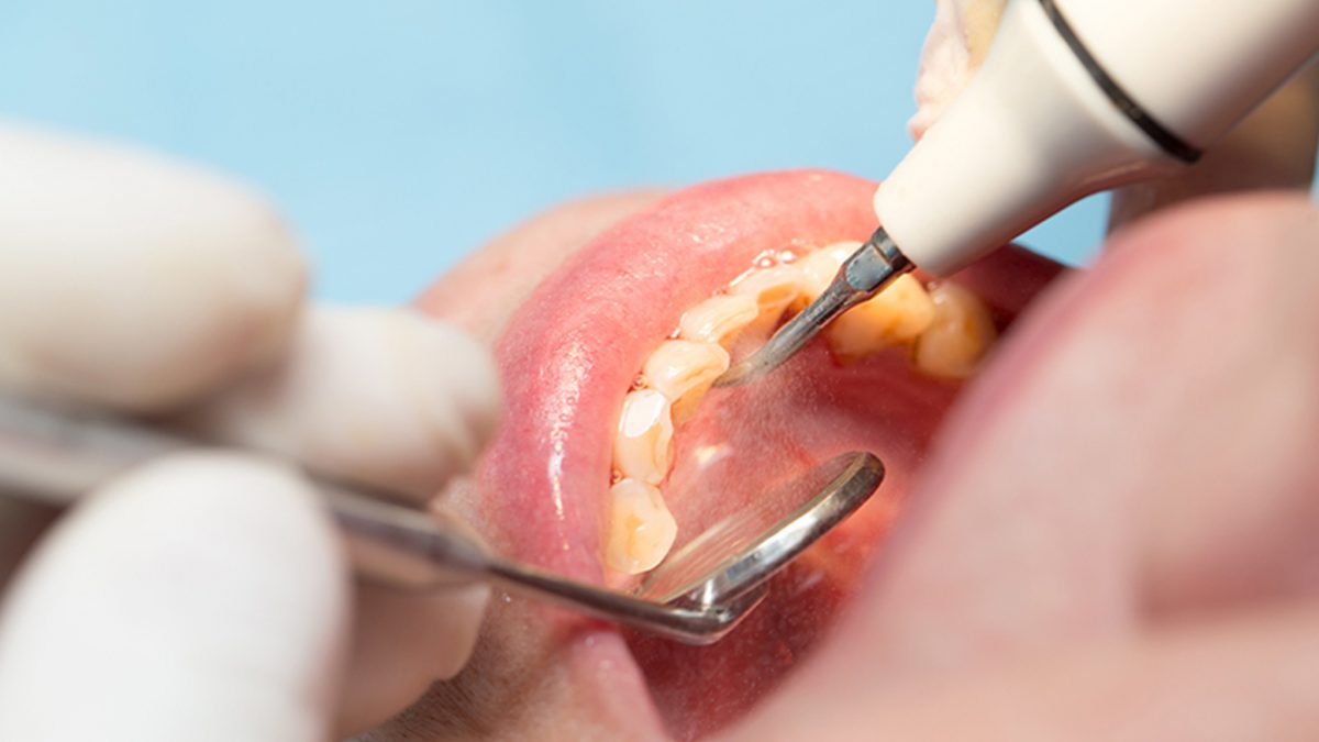 dental clinic in Zirakpur