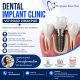 Dental Implant Clinic VIP Road Zirakpur