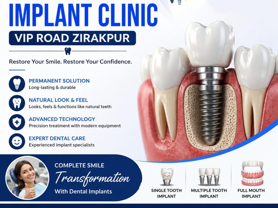 Dental Implant Clinic VIP Road Zirakpur