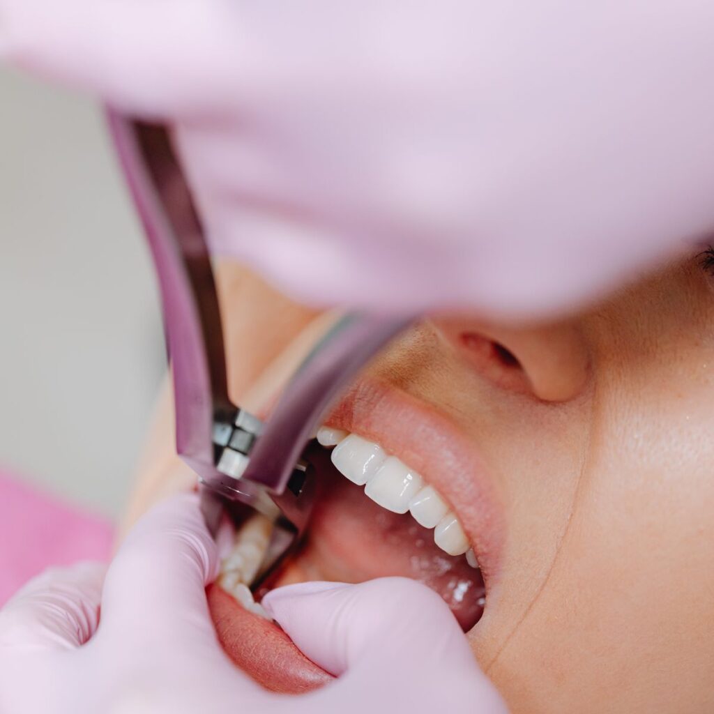 Dentist performing a gentle tooth extraction