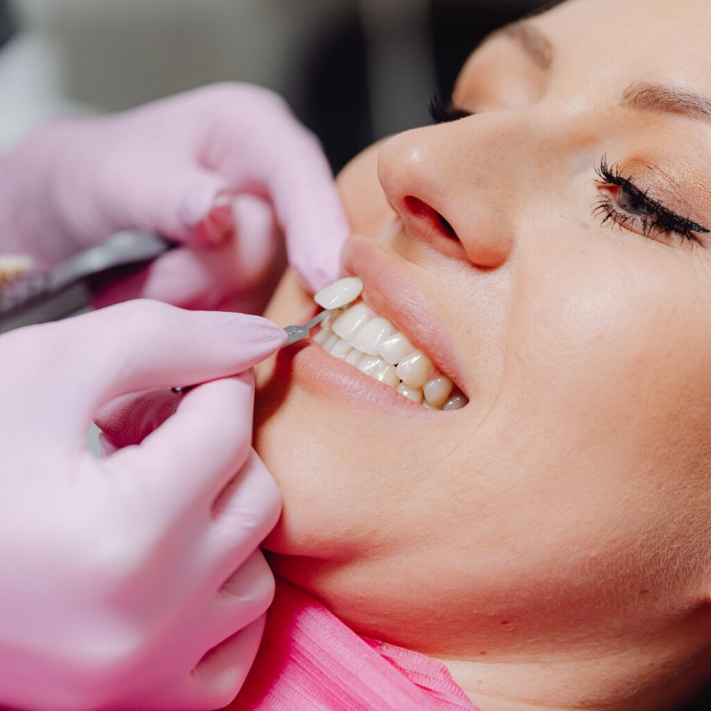 Dentist fitting dental veneers for a patient